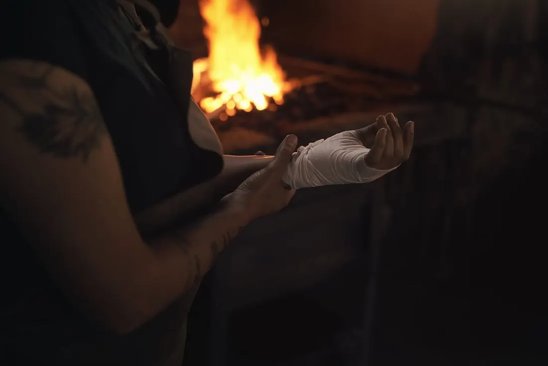 ¿Qué pasa si te haces una herida en un tatuaje? Guía completa para proteger tu piel tatuada ¿Qué pasa si te haces una herida en un tatuaje? Guía completa para proteger tu piel tatuada