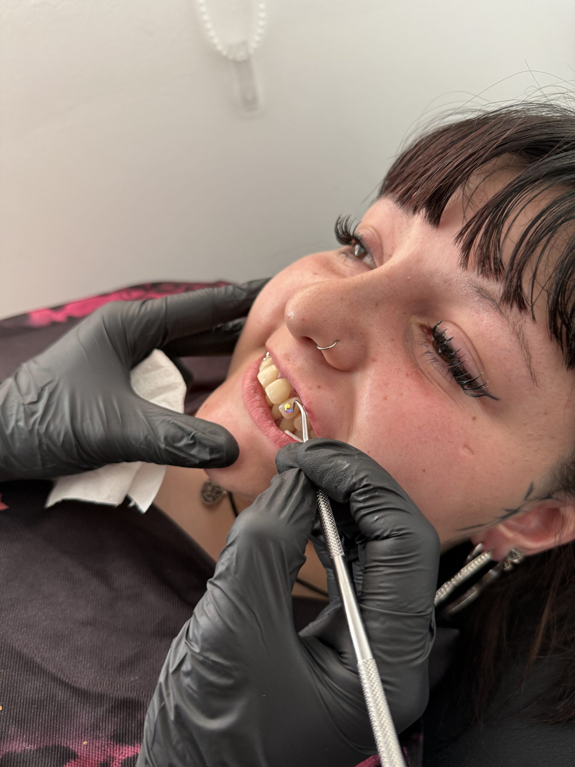Gemas dentales 2